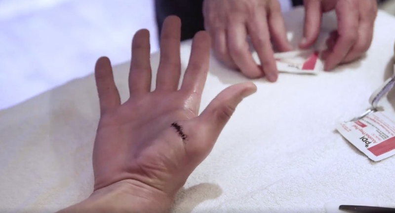 Illustration for article titled Tom Brady Reveals That His Thumb Injury Was Gross